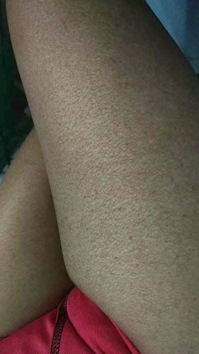 Pretoromeu2's Profile